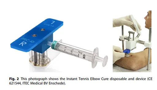 Wat werkt bij de tenniselleboog?